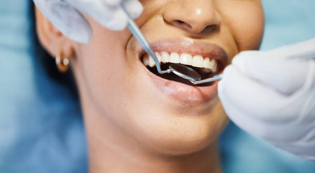 Best Knocked-Out Tooth Emergency  in Mccormick, SC