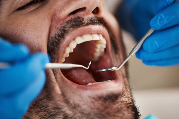 Best Tooth Pain Emergency Relief  in Mccormick, SC